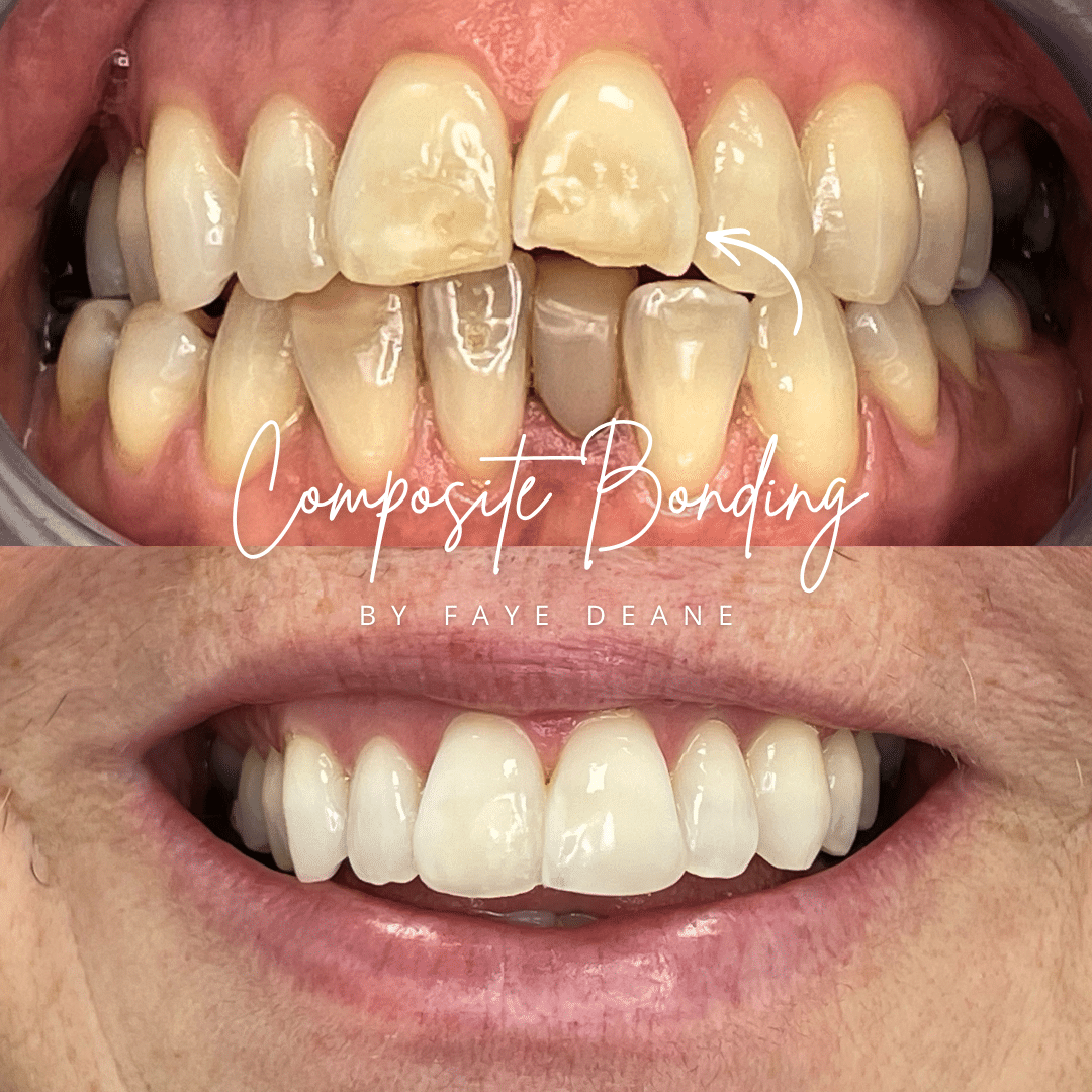 North Bridge Dental Practice Private Dental Practice in Hawick North Bridge - Before and After