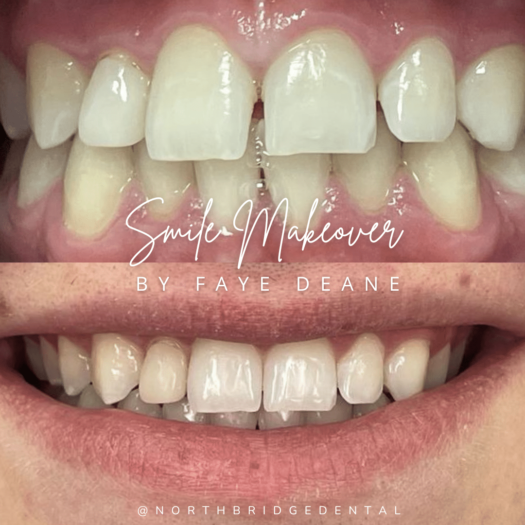 North Bridge Dental Practice Private Dental Practice in Hawick North Bridge - Before and After
