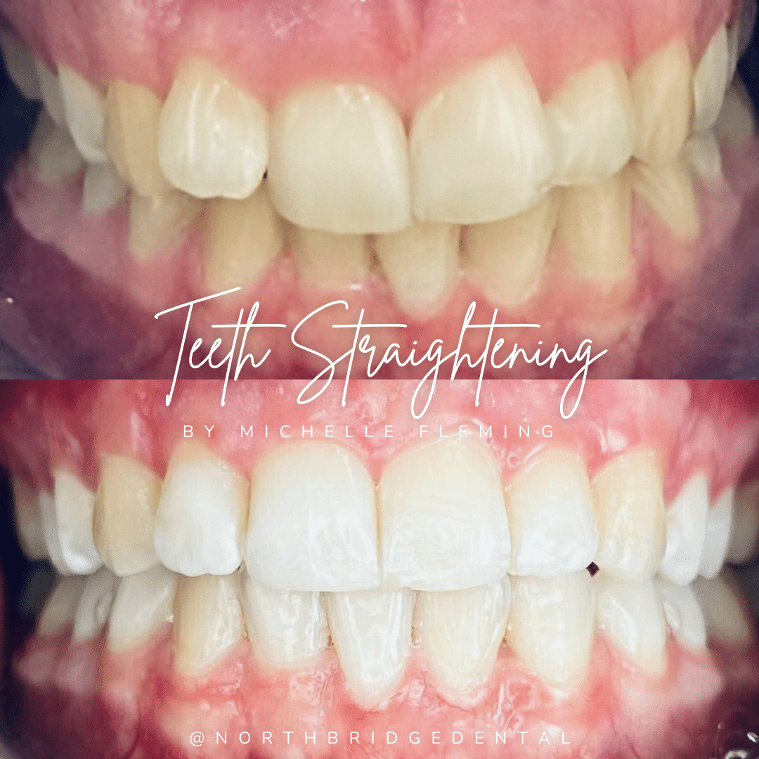 North Bridge Dental Practice Private Dental Practice in Hawick Before and after treatment at North Bridge Dental in Hawick
